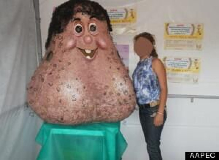 'Mr. Balls': Brazilian Cancer Mascot Is A Pair Of Testicles