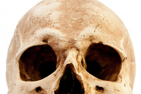 New deformed skulls from France a similar to those found in Mexico.