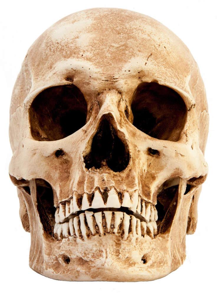 New deformed skulls from France a similar to those found in Mexico. 
