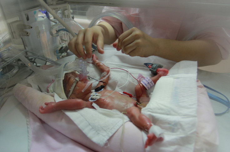 Premature Baby 