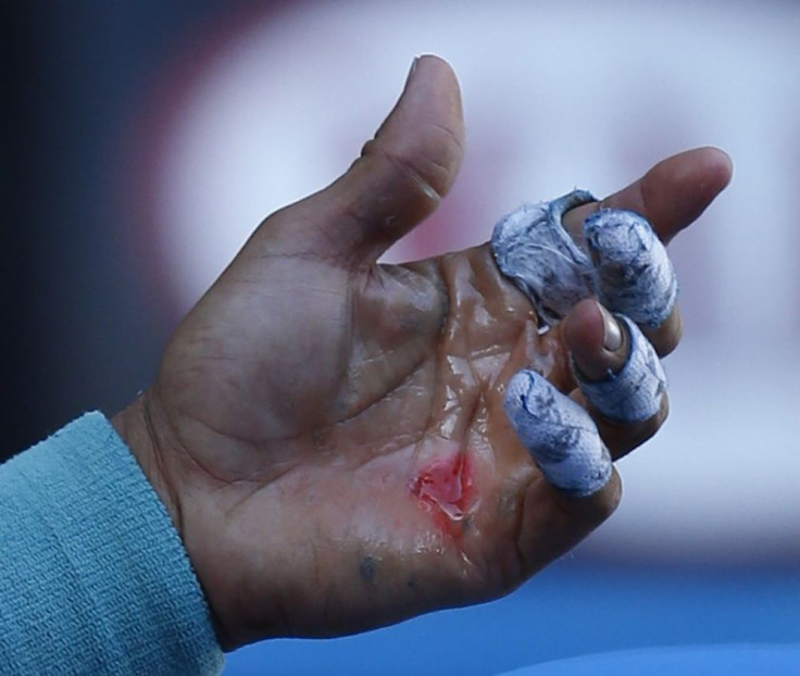 Nadal Hand Blisters Reuters