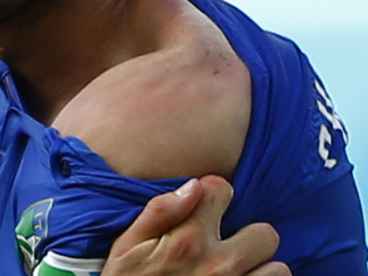 Chiellini's shoulder