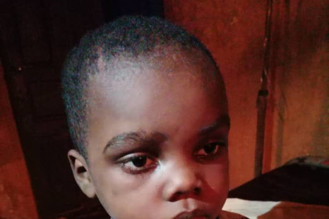 The battered children were brutally bruised, and recused in a semi-conscious state