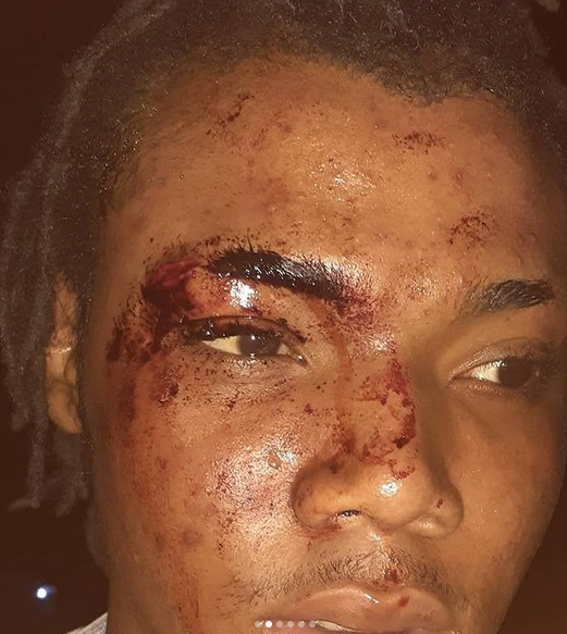 Content Creator attacked by men in Nigerian police uniform