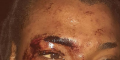 Content Creator attacked by men in Nigerian police uniform