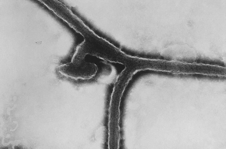 Ultrastructural morphology exhibited by the Marburg virus