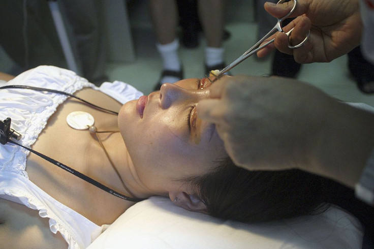 China Cosmetic Surgery