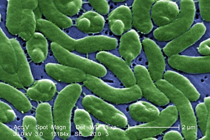 Grouping of Vibrio vulnificus bacteria