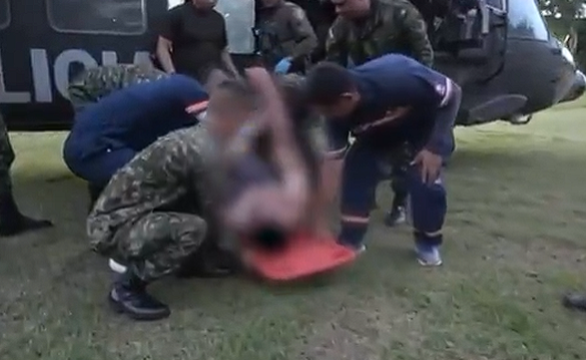 Soldier burned