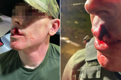 Injured ICE officer in Houston