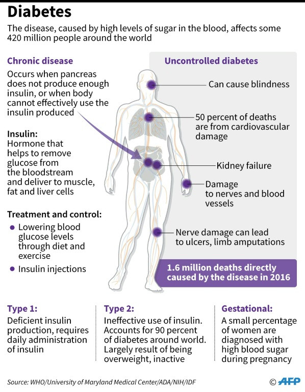 Diabetes Infograph