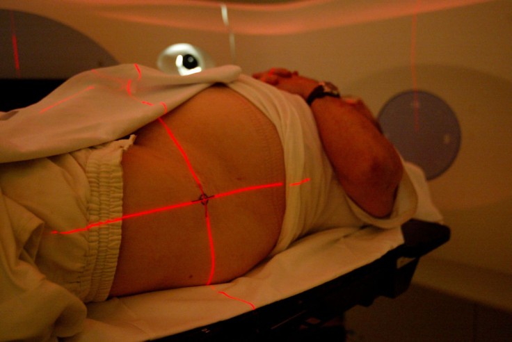 Lasers are precisely pinpointed on a patient with prostate cancer